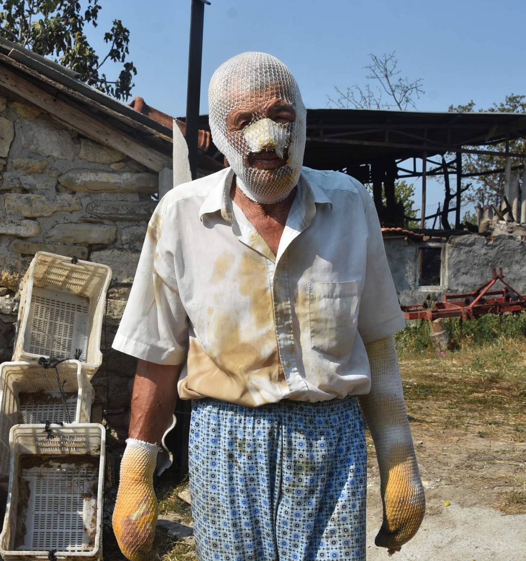 Yangında hayvanlarını kurtarmak istedi, ölümden döndü 5