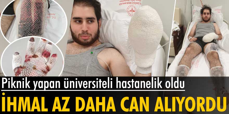 Ankara’da piknik yapan Doruk Özcan az daha canından oluyordu