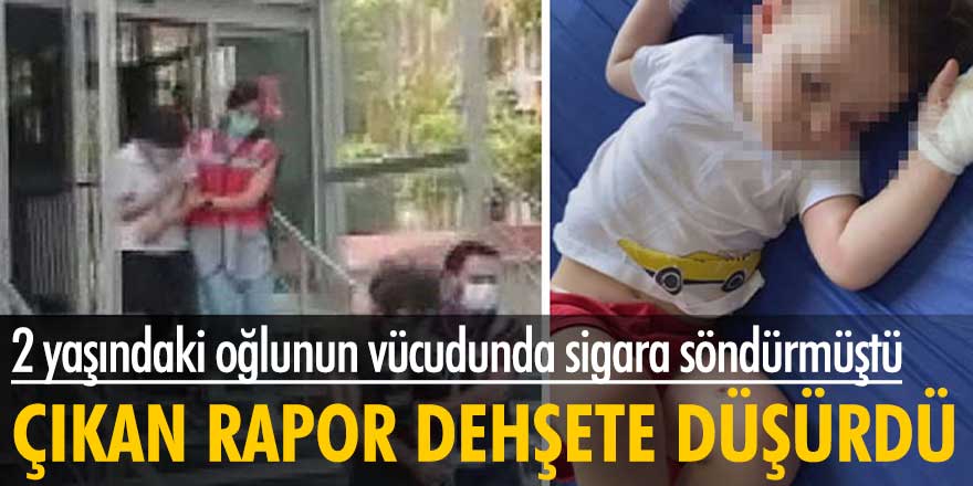 Adli Tıp raporu dehşeti ortaya çıkardı! 2 yaşındaki çocuğa akıl almaz işkence