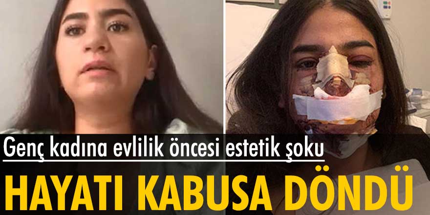 Avusturya'dan İstanbul'a gelen Güllü Gökçe'ye evlilik öncesi estetik şoku