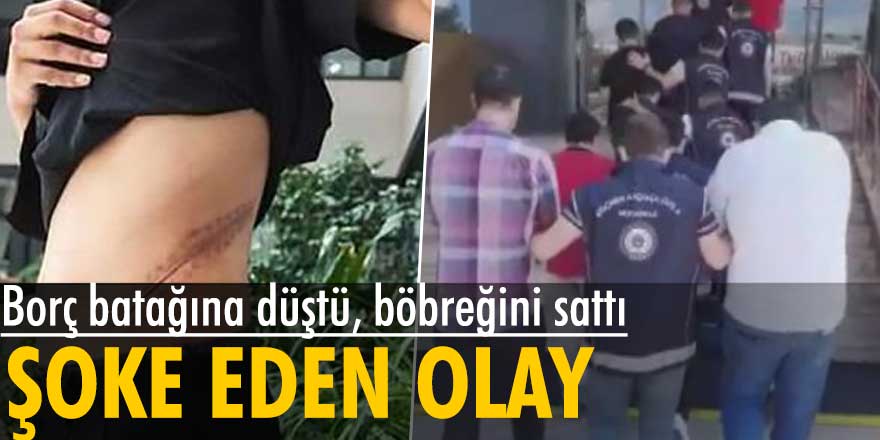 Şoke eden olay! Borç batağına düştü, böbreğini sattı