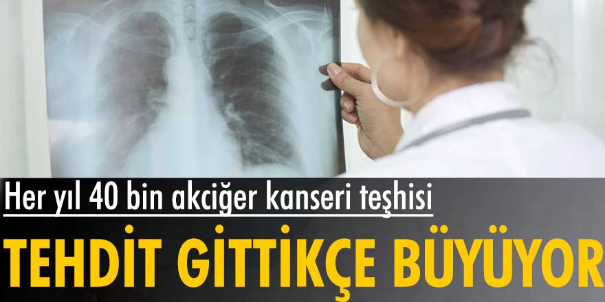 Türkiye'de her yıl 40 bin kişiye akciğer kanseri teşhisi... Tehdit gittikçe büyüyor