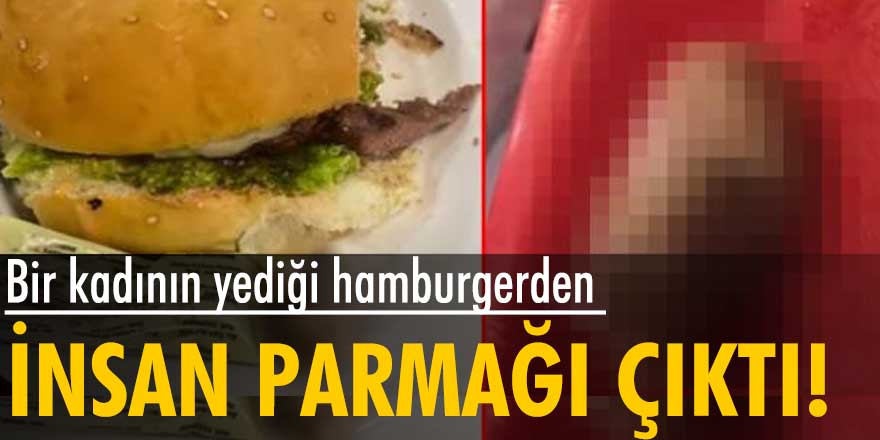 Yediği hamburgerden insan parmağı çıktı