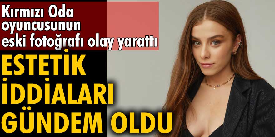 İlayda Alişan'ın eski fotoğrafı olay yarattı! Estetik iddiaları gündem oldu