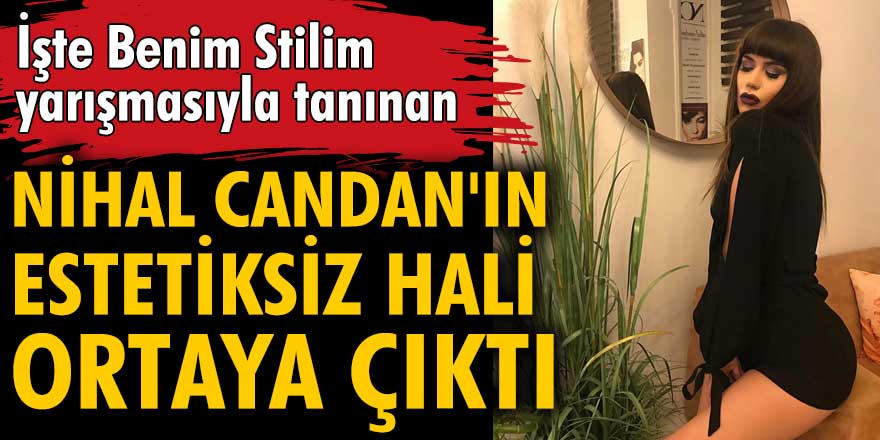 Nihal Candan'ın estetiksiz hali ortaya çıktı!