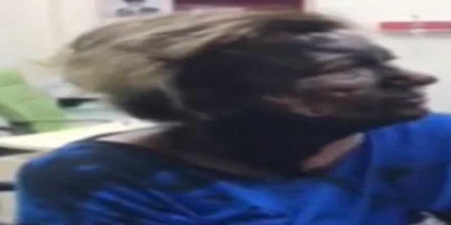 Adana'da korkunç olay! Tanınmaz hale geldi