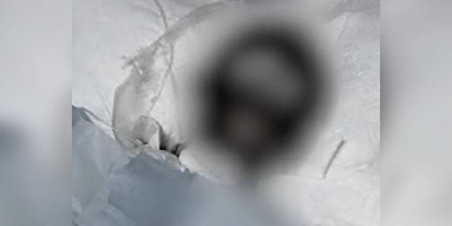 Böyle canilik görülmedi! Eşini benzin döküp yaktı