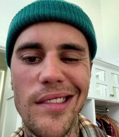 Justin Bieber yüz felcinin ardından sahnelere geri döndü