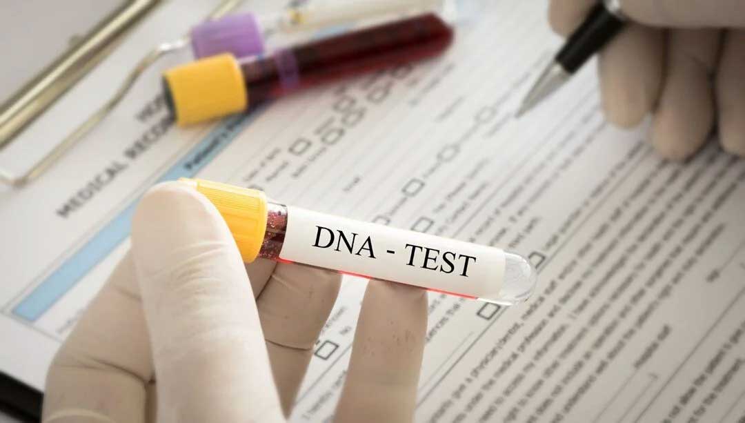 DNA testi yaptı serveti kaptı!