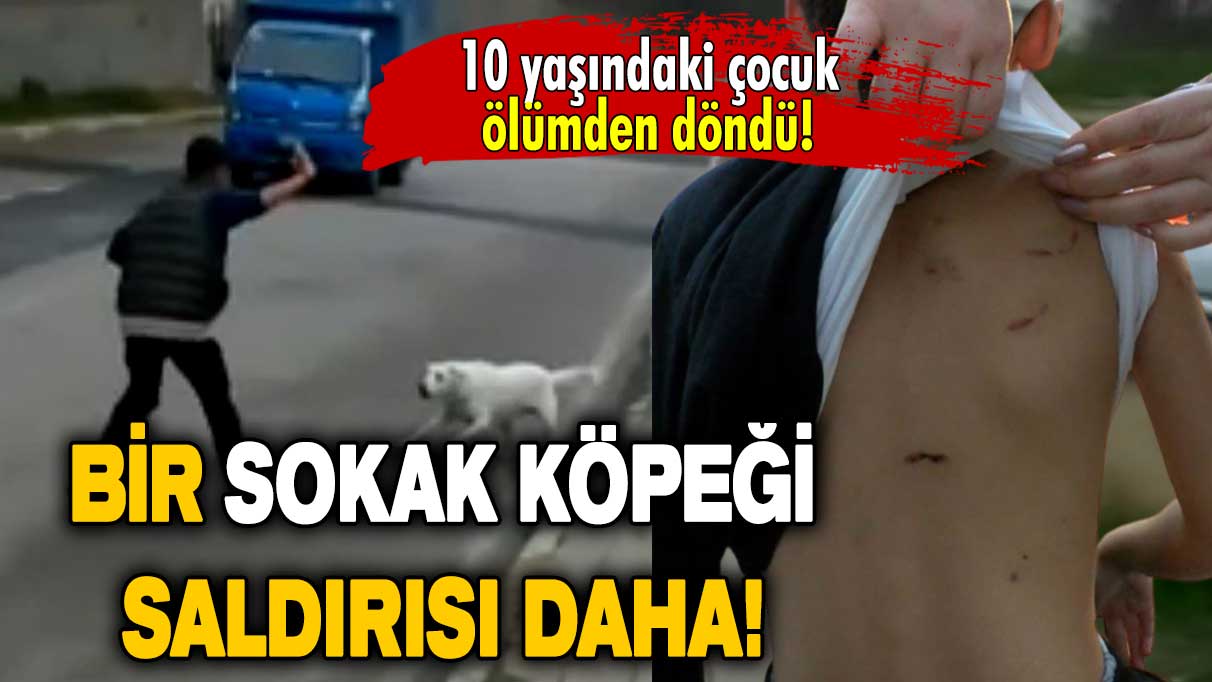 Bir sokak köpeği saldırısı daha: 10 yaşındaki çocuk ölümden döndü!