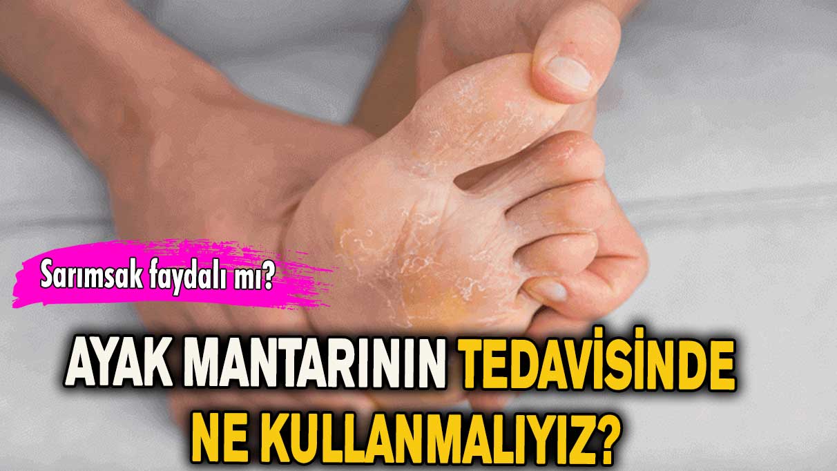 Ayak mantarının belirtileri nelerdir?