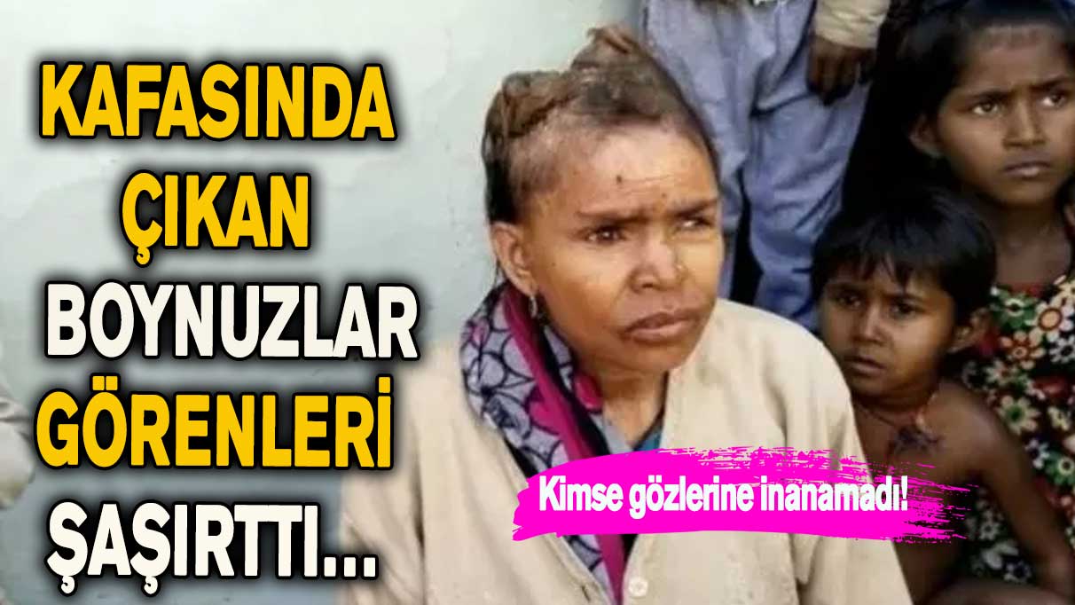 Kimse gözlerine inanamadı! Kafasında çıkan şeyler görenleri şaşırttı…