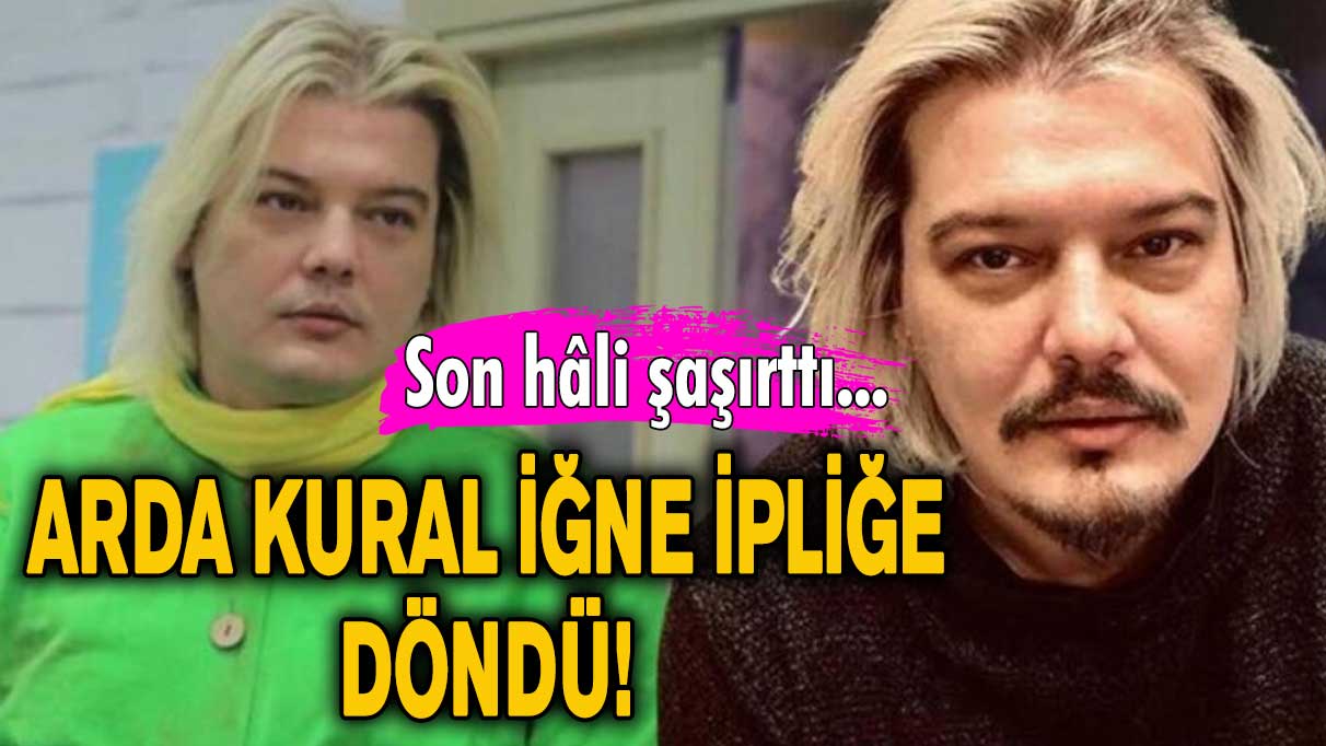 Arda Kural iğne ipliğe döndü! Son hâlini görenler gözlerine inanamadı…