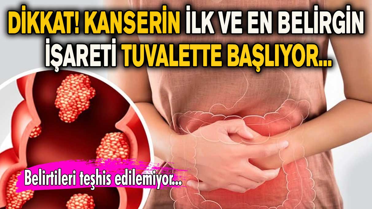 Dikkat! Kanserin ilk ve en belirgin işareti tuvalette başlıyor...