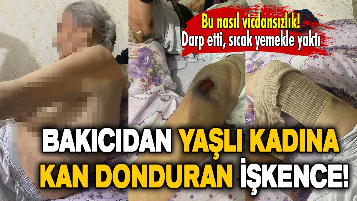 Bakıcıdan yaşlı kadına kan donduran işkence!