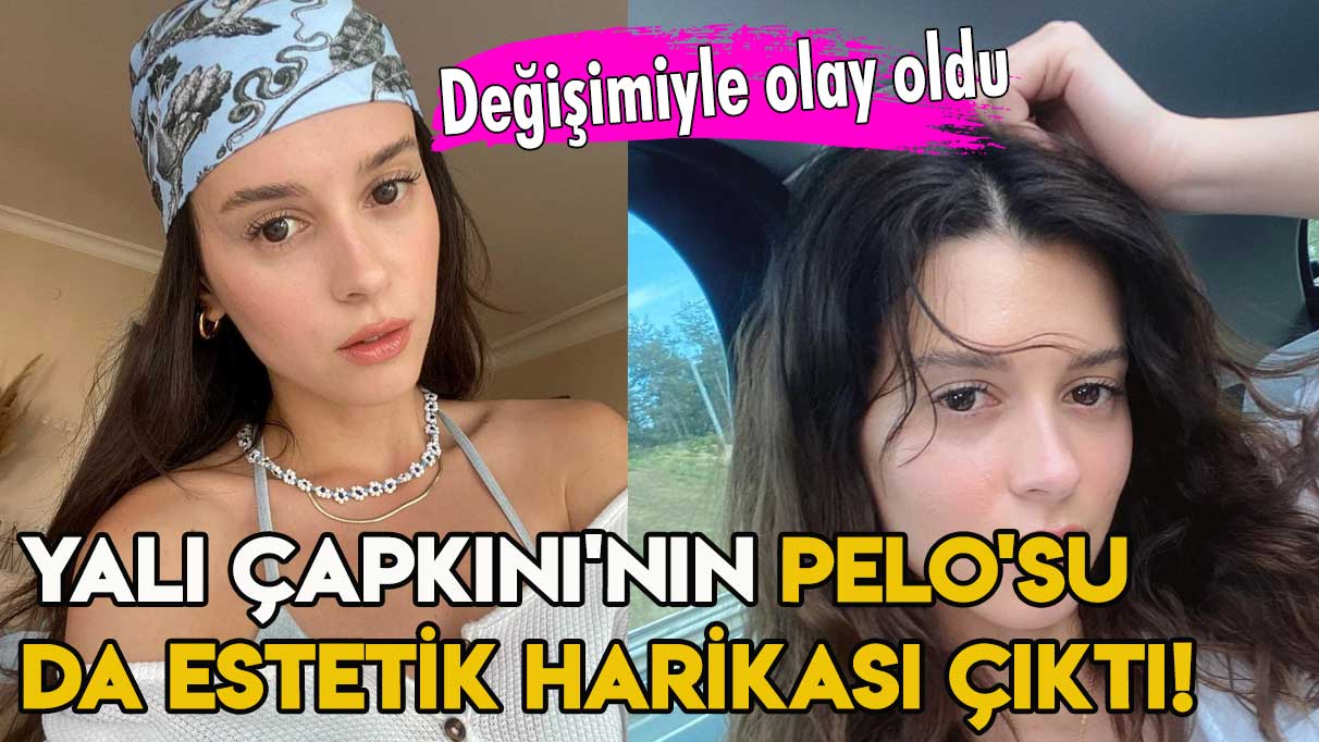 Yalı Çapkını'nın Pelo'su da estetik harikası çıktı!