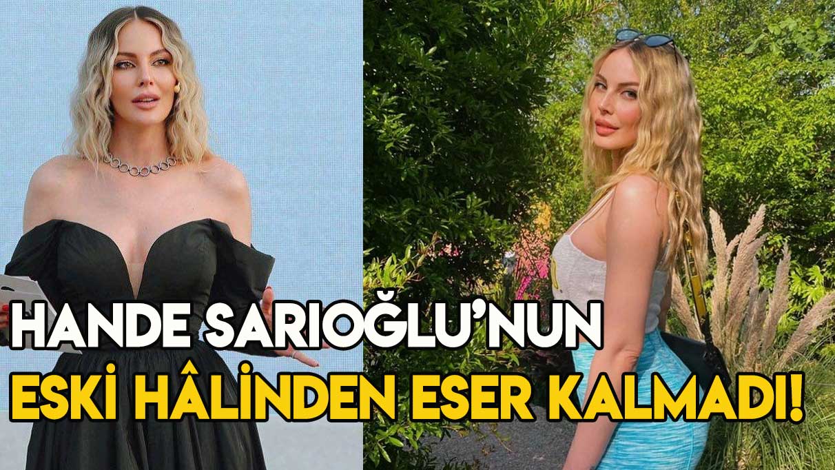 Hande Sarıoğlu’nun eski hâlinden eser kalmadı!