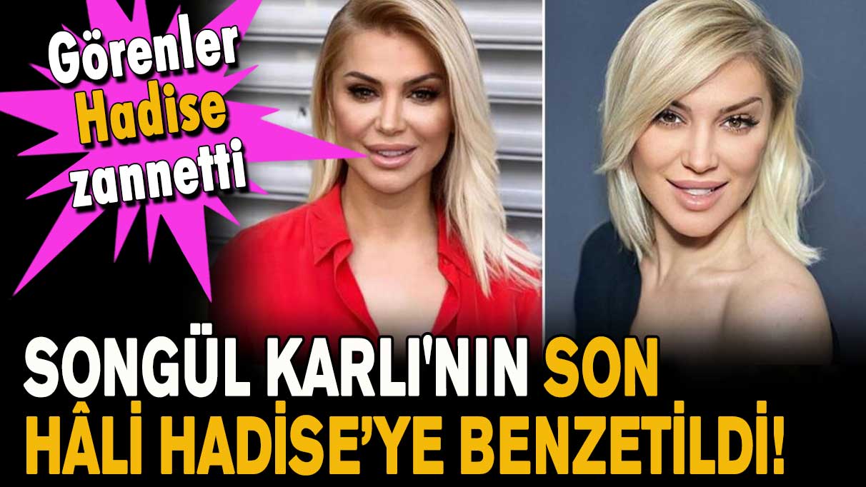 Songül Karlı'nın son hâli Hadise’ye benzetildi! Görenler Hadise zannetti