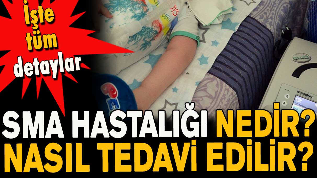 SMA hastalığı nedir? Nasıl tedavi edilir?