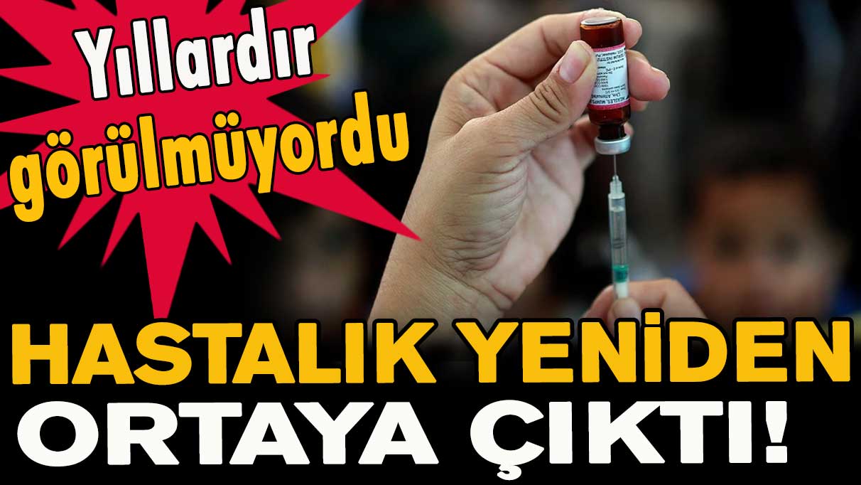 Yıllardır görülmeyen hastalık yeniden ortaya çıktı!