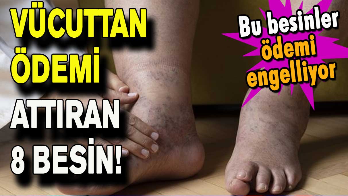 Vücuttan ödemi attıran 8 besin!