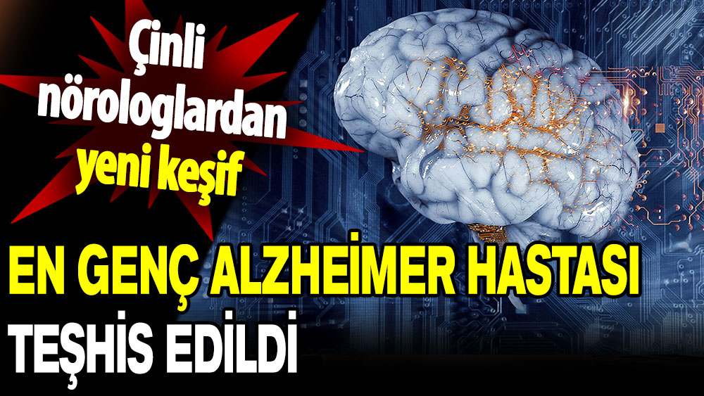 Çinli nörologlardan yeni keşif: En genç Alzheimer hastası teşhis edildi!