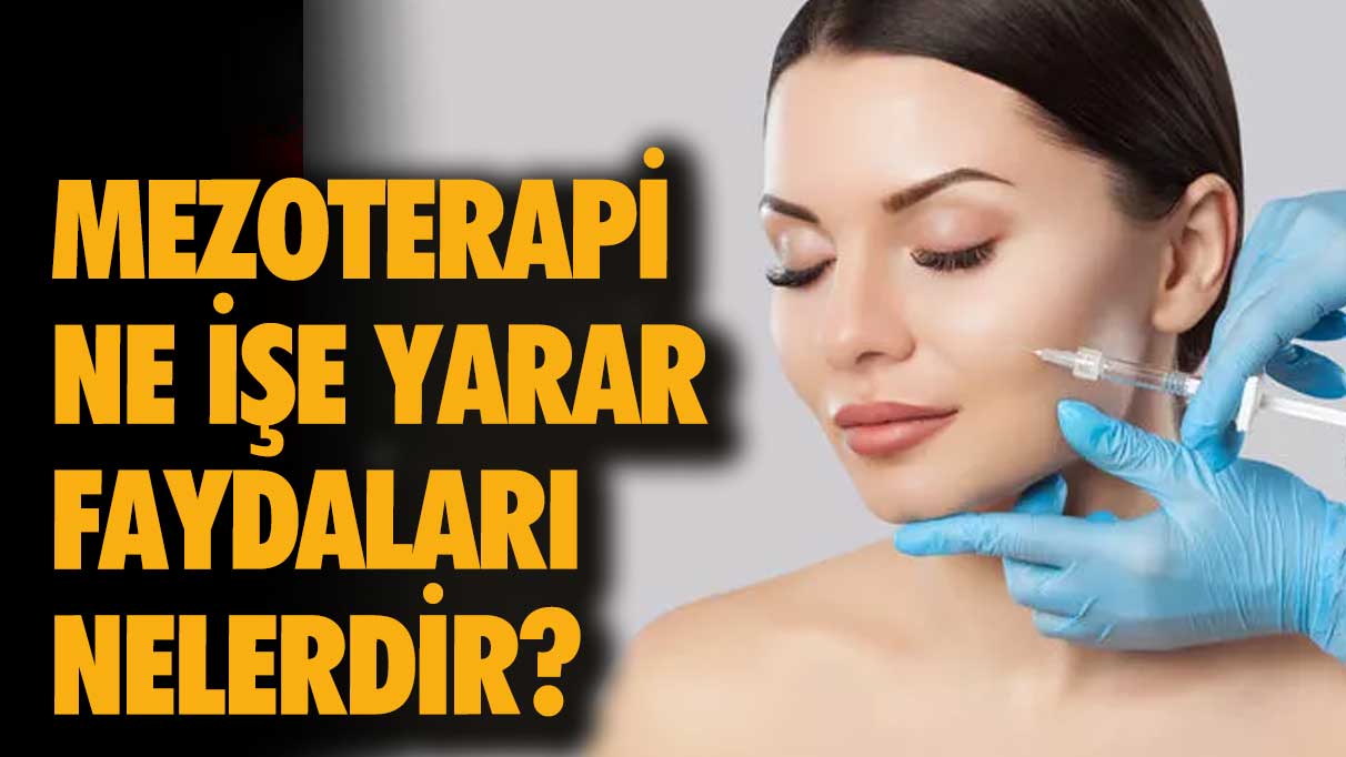 Mezoterapi ne işe yarar, faydaları nelerdir?