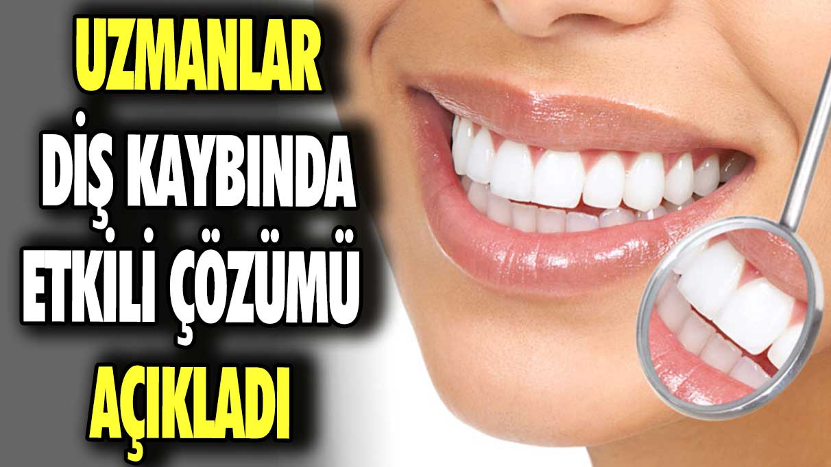 Uzmanlar diş kaybında etkili çözümü açıkladı