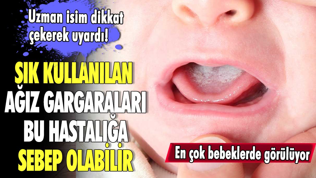 Uzman isim dikkat çekerek uyardı! Sık kullanılan ağız gargaraları bu hastalığa sebep olabilir.. En çok bebeklerde görülüyor