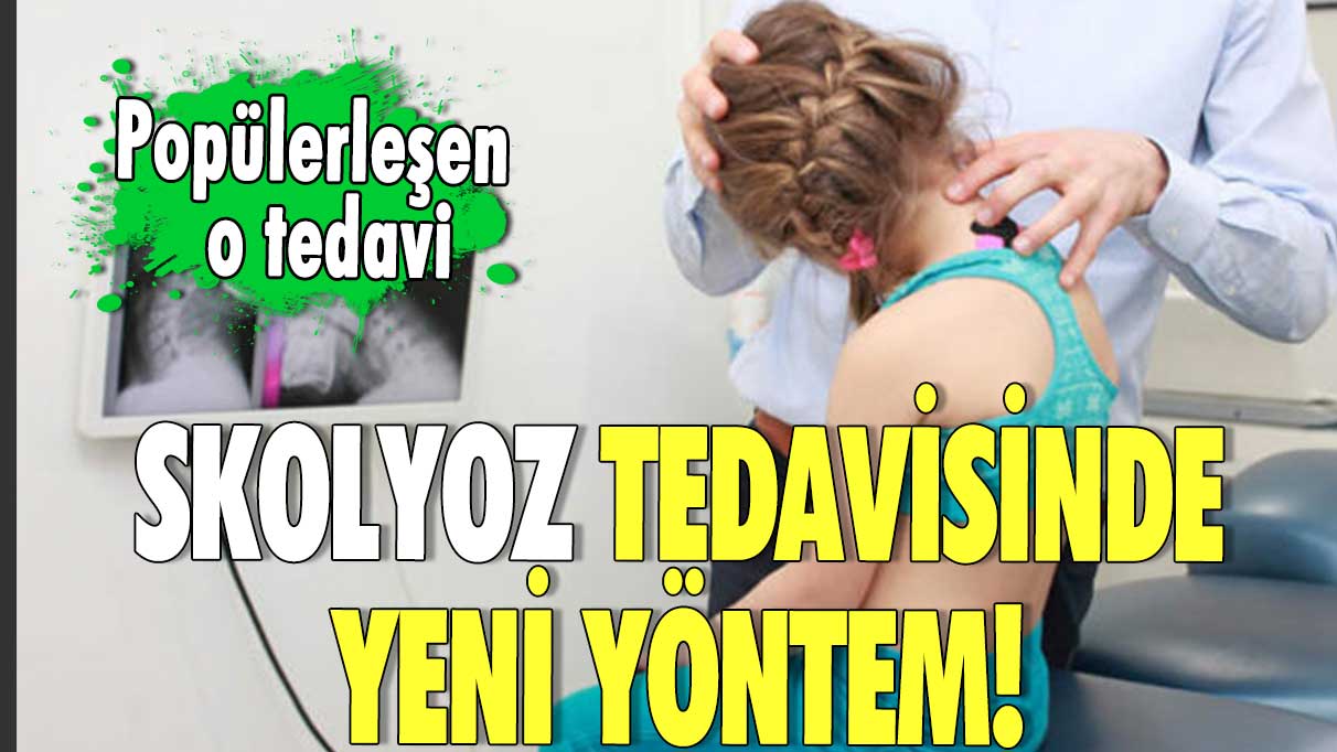 Skolyoz tedavisinde yeni yöntem! Popülerleşen o tedavi