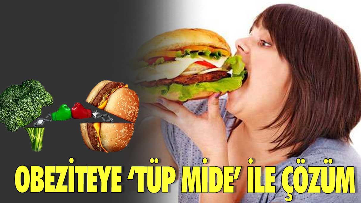 Obeziteye ‘tüp mide’ ile çözüm