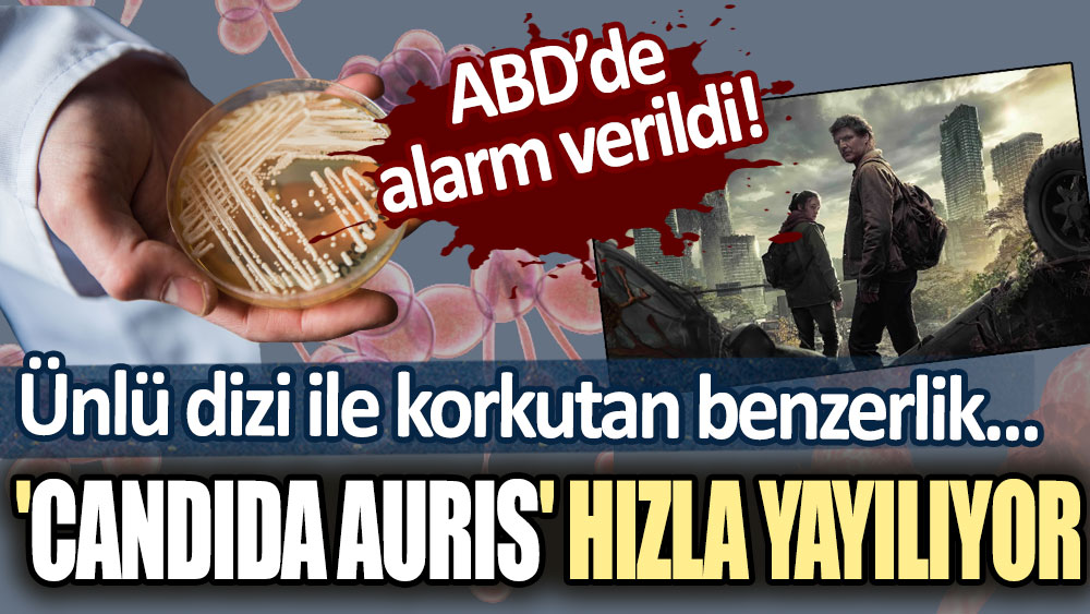 ABD'de alarm çanları çaldı! Ünlü dizi ile korkutan benzerlik: Candida auris hızlıca yayılıyor