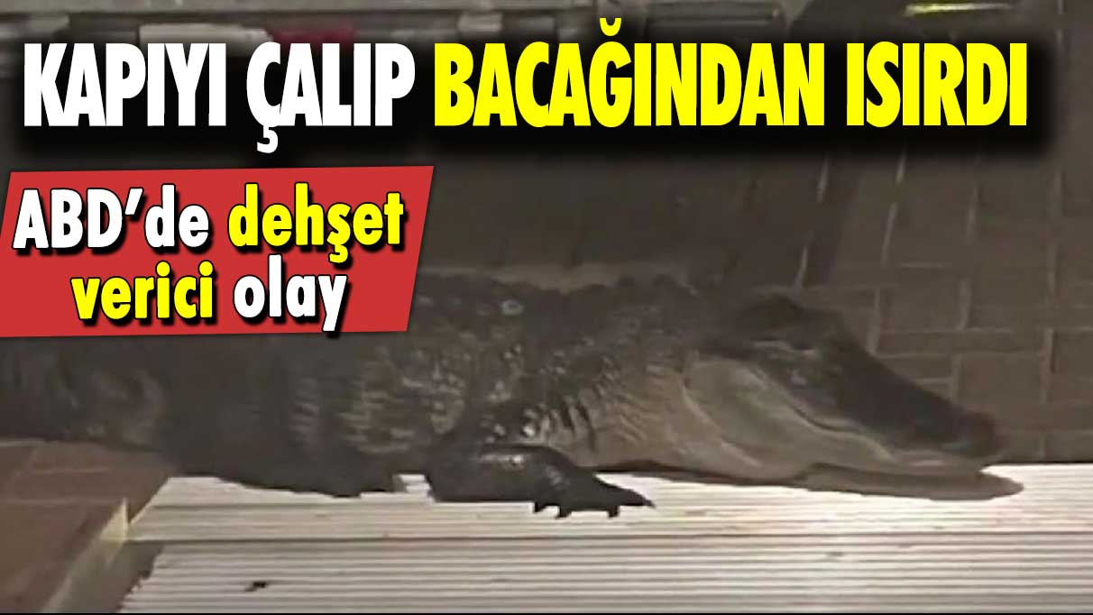 ABD’de dehşet verici olay: Kapıyı çalıp bacağından ısırdı