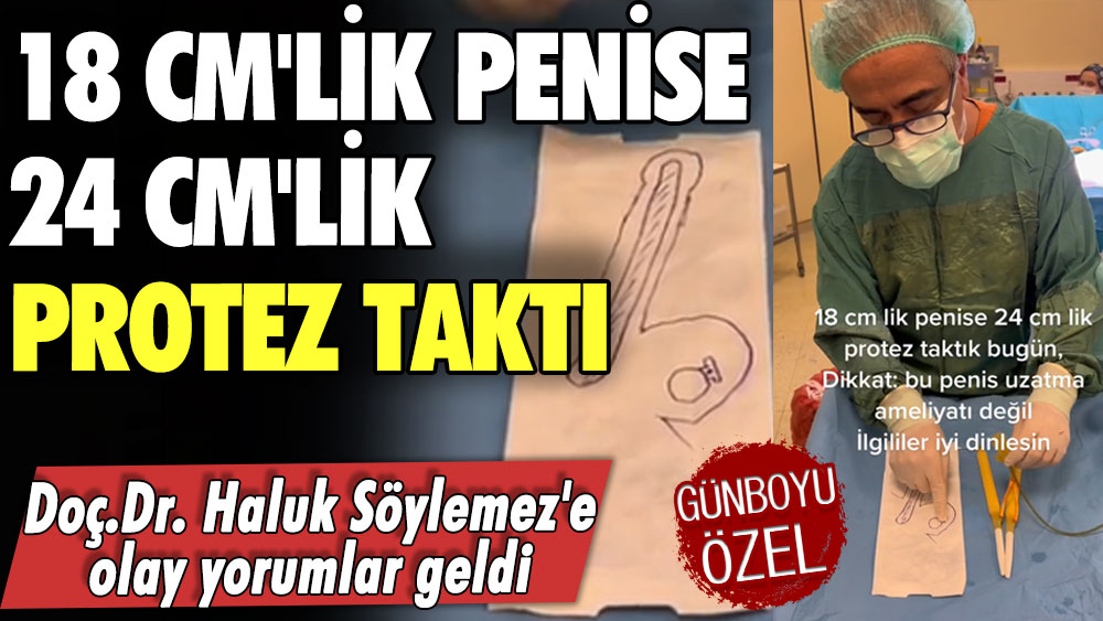 18 cm'lik penise 24 cm'lik protez taktı! Doç.Dr. Haluk Söylemez'e olay yorumlar geldi