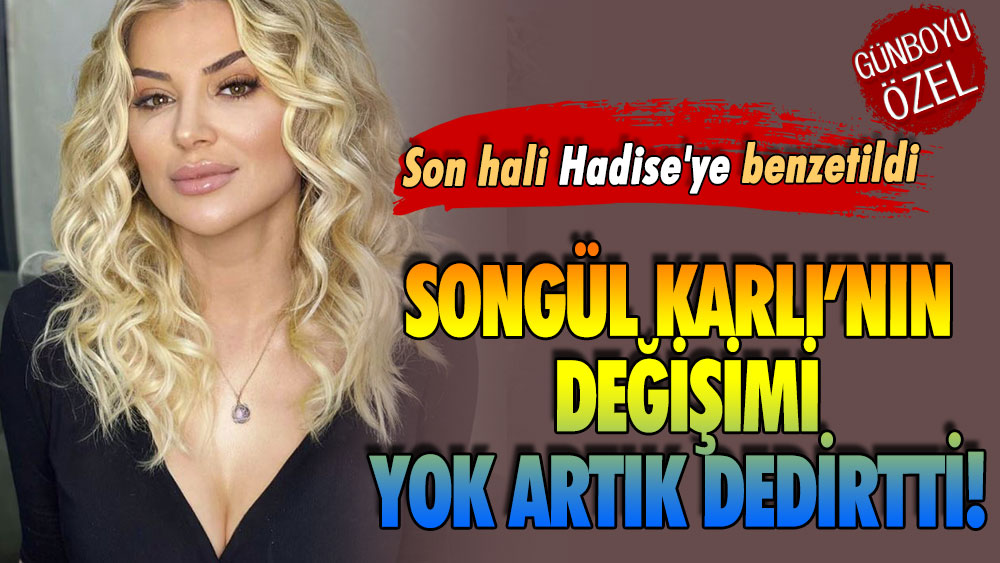 Songül Karlı’nın değişimi yok artık dedirtti! Son hali Hadise'ye benzetildi