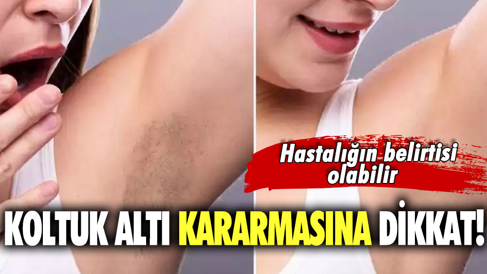 Koltuk altı kararmasına dikkat! Hastalığın belirtisi olabilir