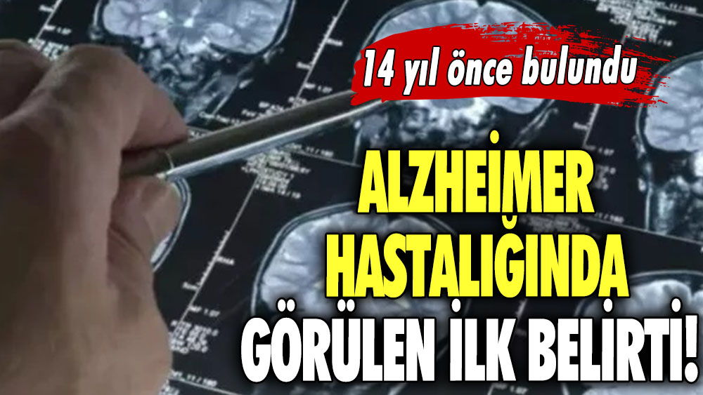 Alzheimer hastalığında görülen ilk belirti! 14 yıl önce bulundu