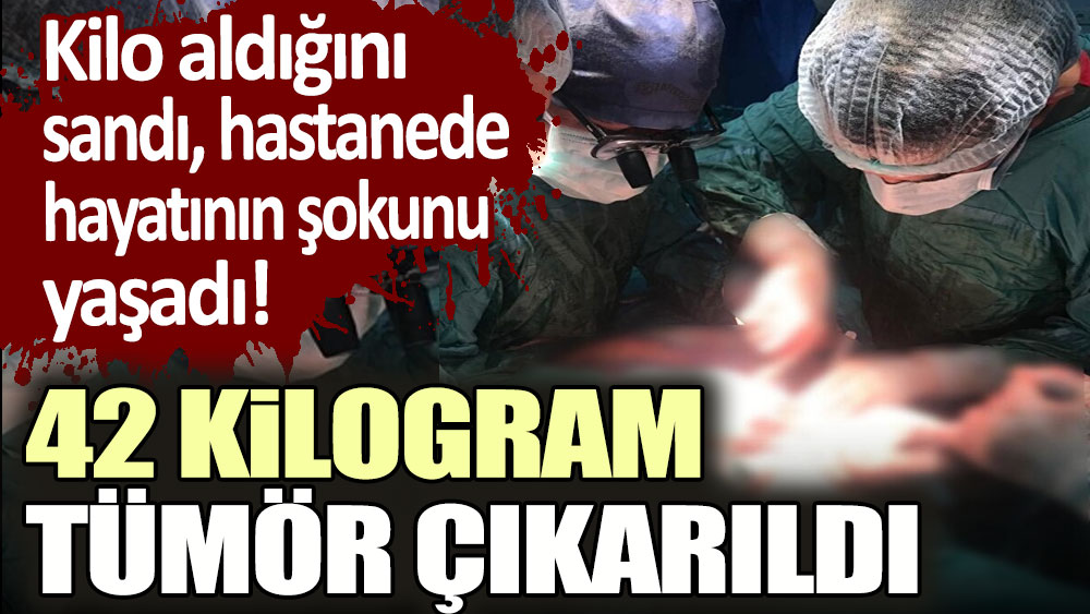 Kilo aldığını sandı: Hastaneye koştu! Tam 42 kilogram tümor çıkarıldı