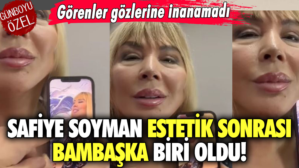 Safiye Soyman estetik sonrası bambaşka biri oldu! Görenler gözlerine inanamadı…