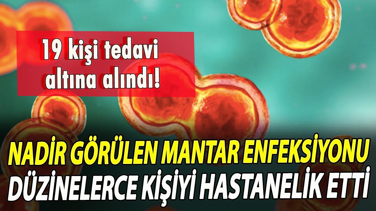 Nadir görülen mantar enfeksiyonu düzinelerce kişiyi hastanelik etti