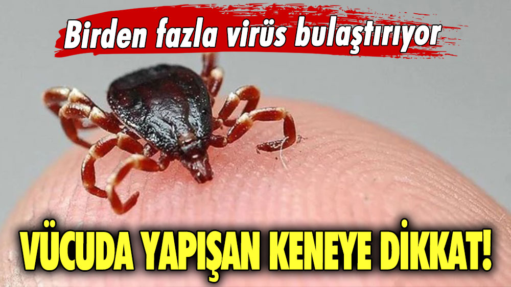 Vücuda yapışan keneye dikkat! Birden fazla virüs bulaştırıyor