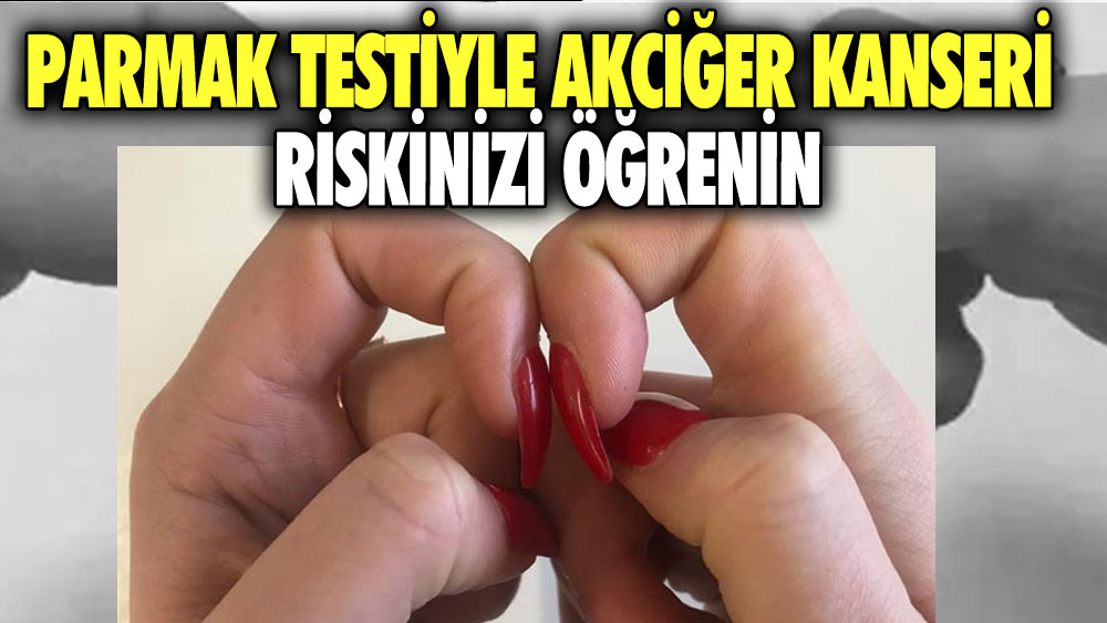 Parmak testiyle akciğer kanseri riskinizi öğrenin