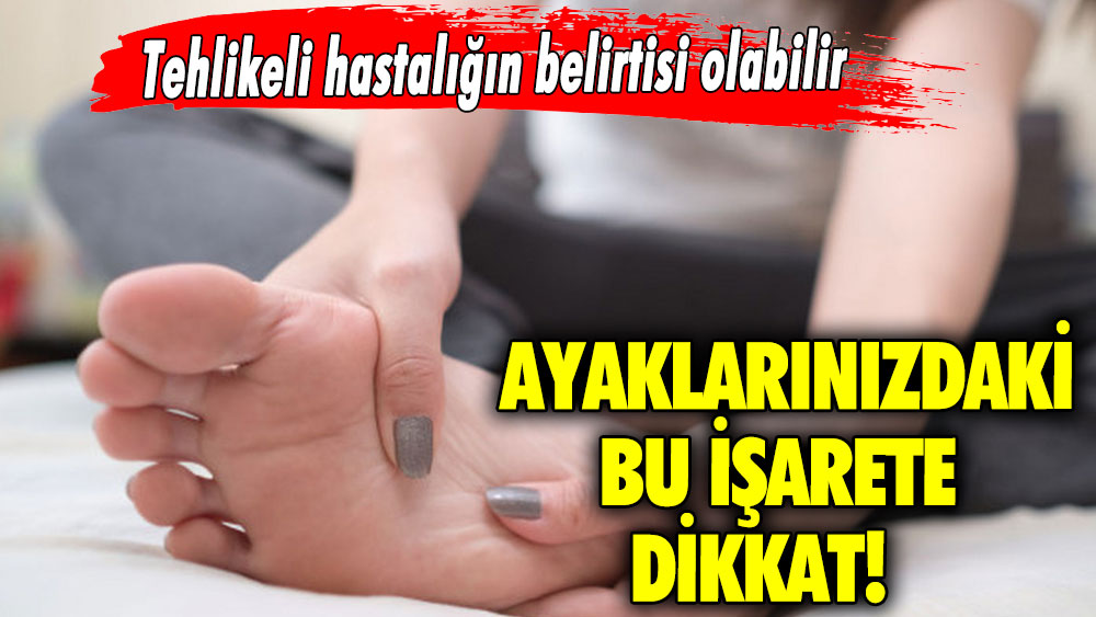 Ayaklarınızdaki bu işarete dikkat! Tehlikeli hastalığın belirtisi olabilir