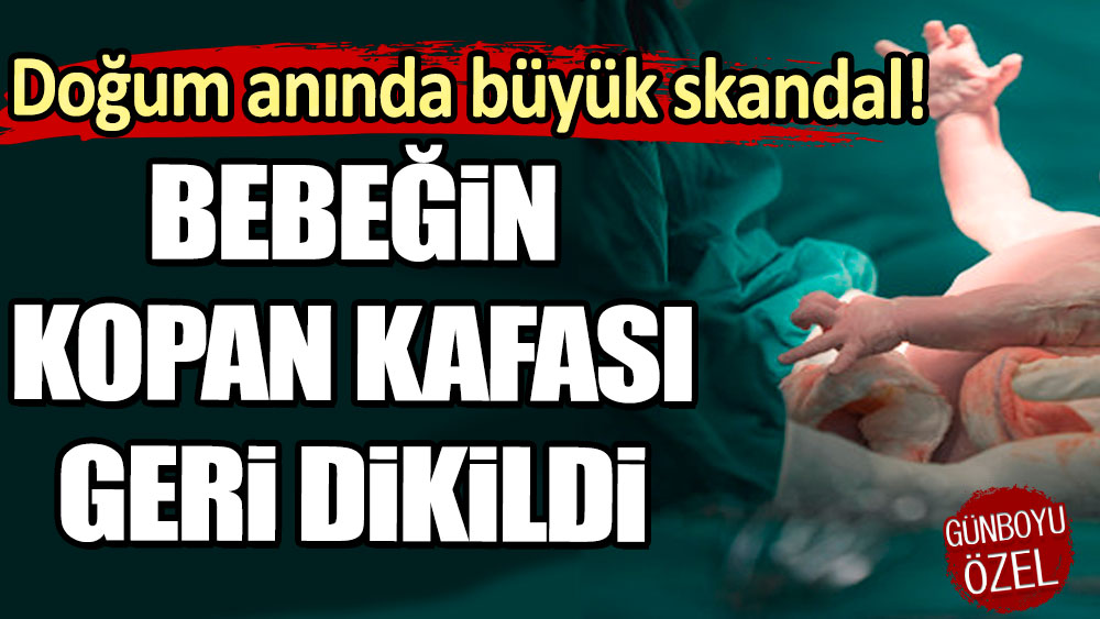 Doğum anında büyük skandal! Bebeğin kopan kafası geri dikildi