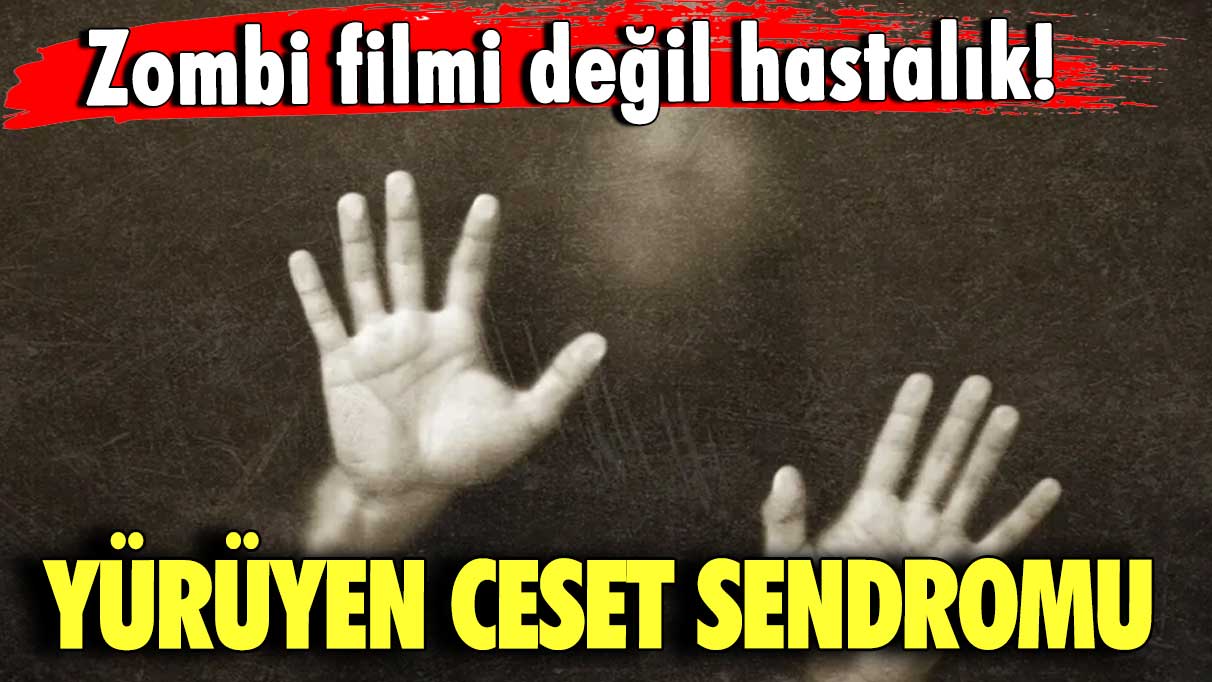 Zombi filmi değil, hastalık!  Yürüyen Ceset Sendromu