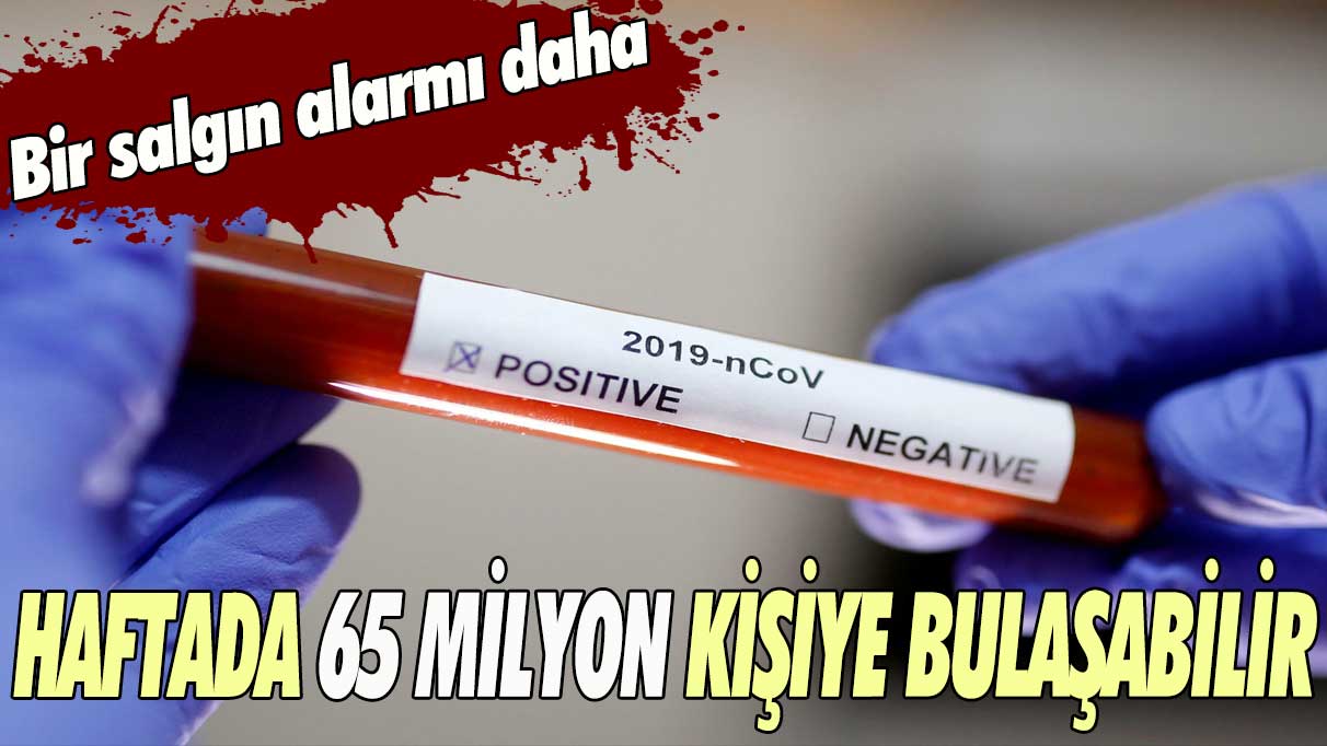 Bir salgın alarmı daha: Haftada 65 milyon kişiye bulaşabilir