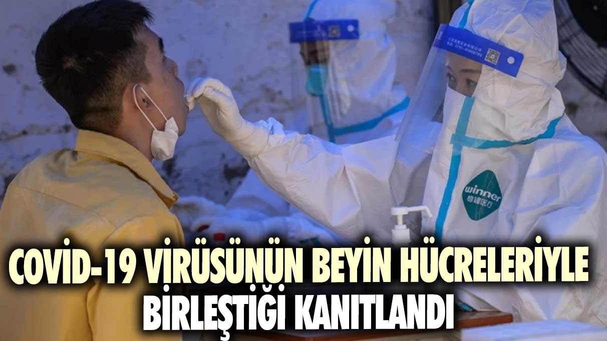 Covid-19 virüsünün beyin hücreleriyle birleştiği kanıtlandı