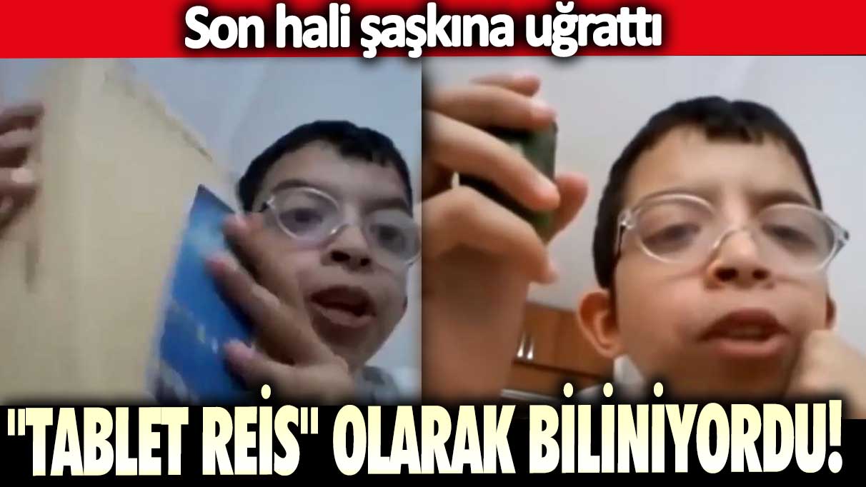 "Tablet Reis" olarak biliniyordu! Son hali şaşkına uğrattı