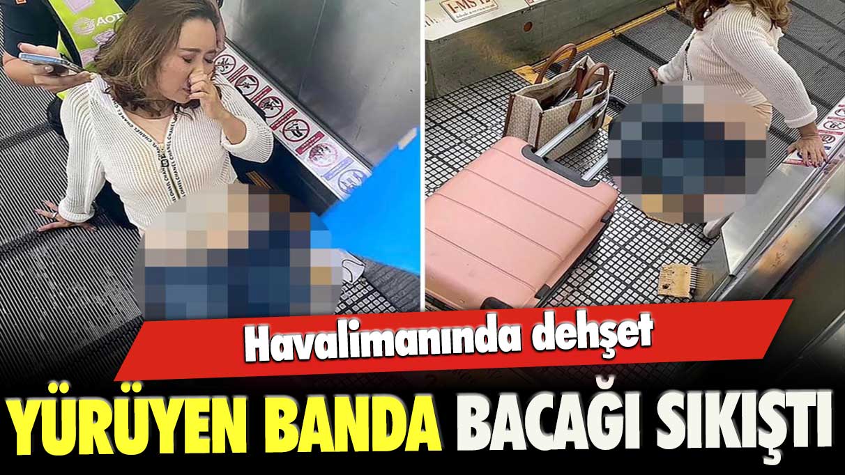 Havalimanında dehşet: Yürüyen banda bacağı sıkıştı