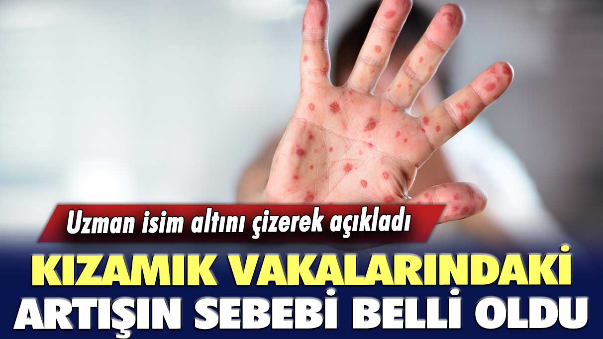 Uzman isim altını çizerek açıkladı  Kızamık vakalarındaki artışın sebebi belli oldu